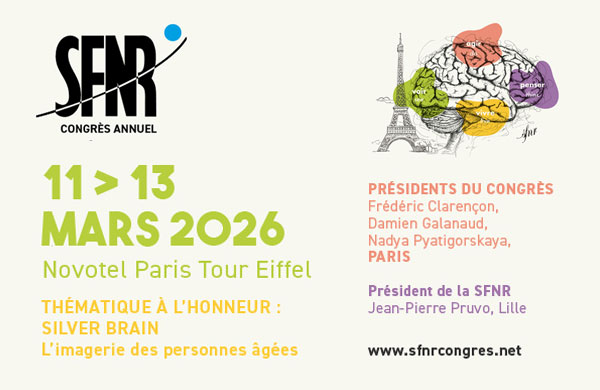 SFNR 2027